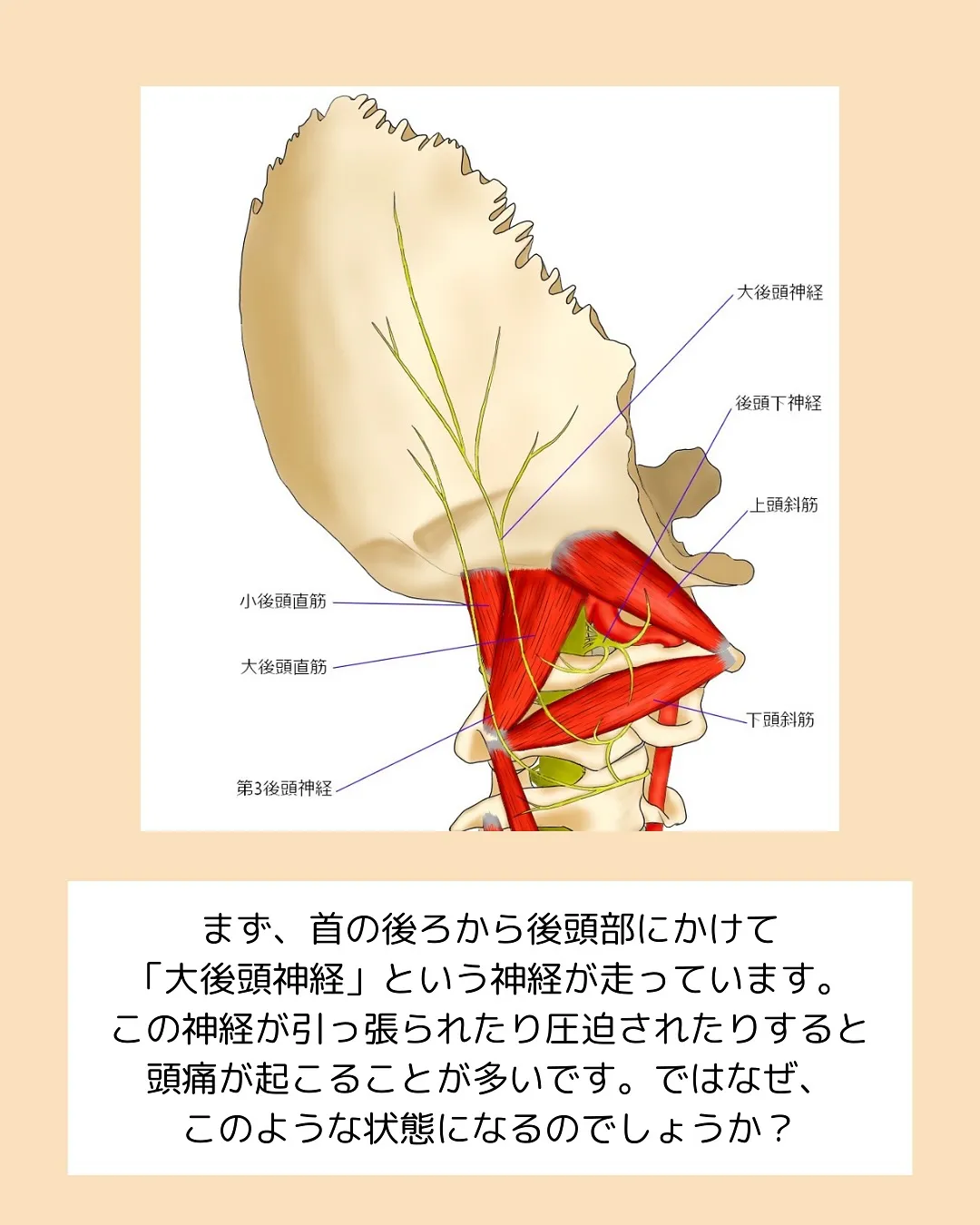 頭痛持ちの方集合‼️