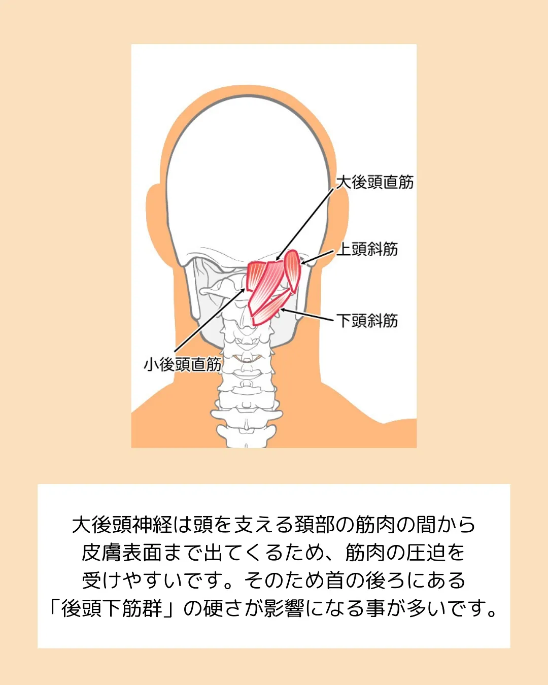 頭痛持ちの方集合‼️