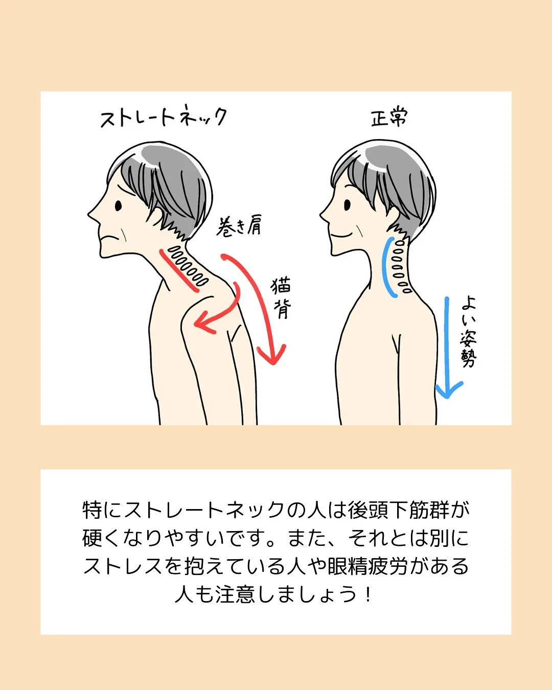 頭痛持ちの方集合‼️