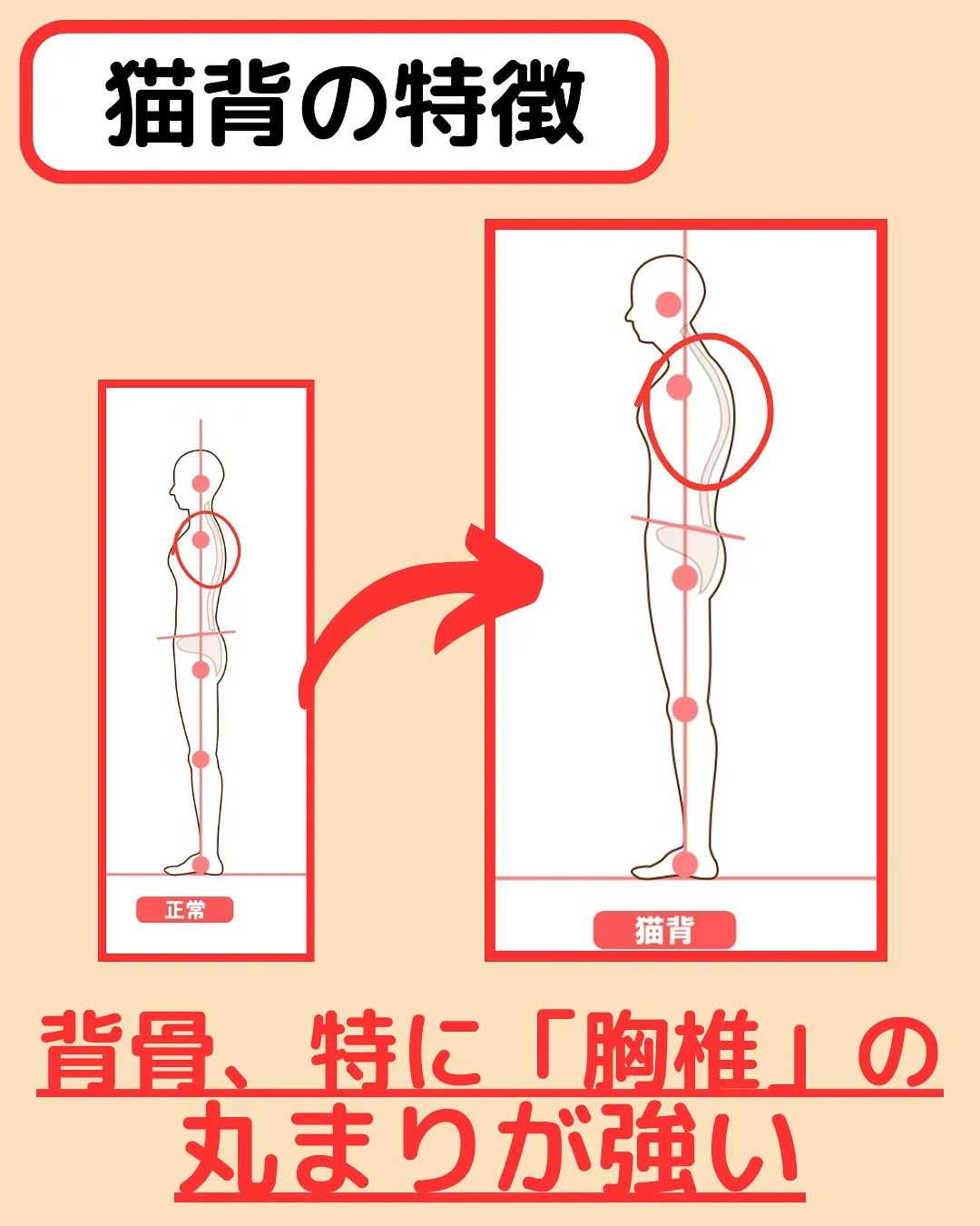【姿勢改善②猫背改善Part2‼️】