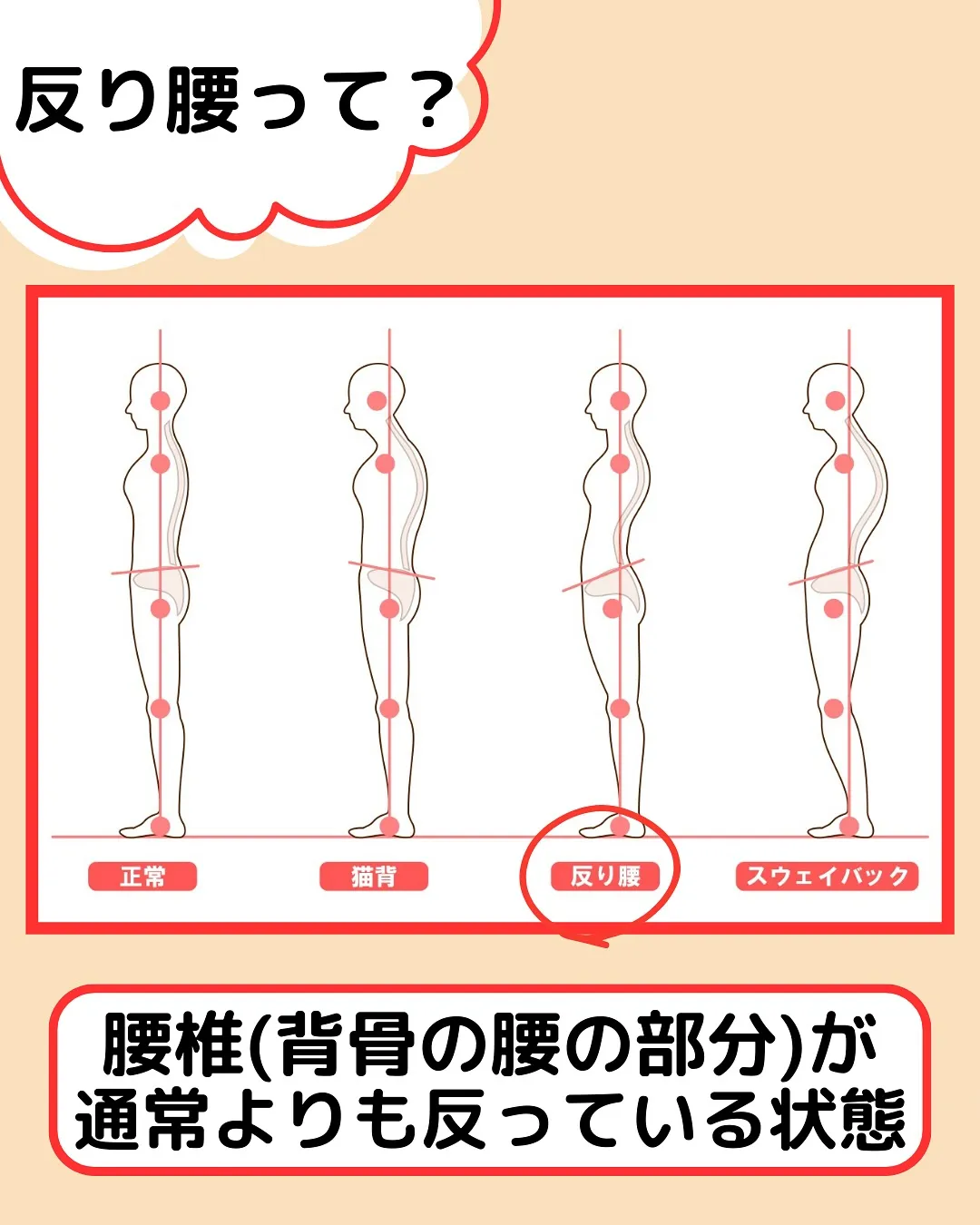 【姿勢改善‼️反り腰改善Part1✨】