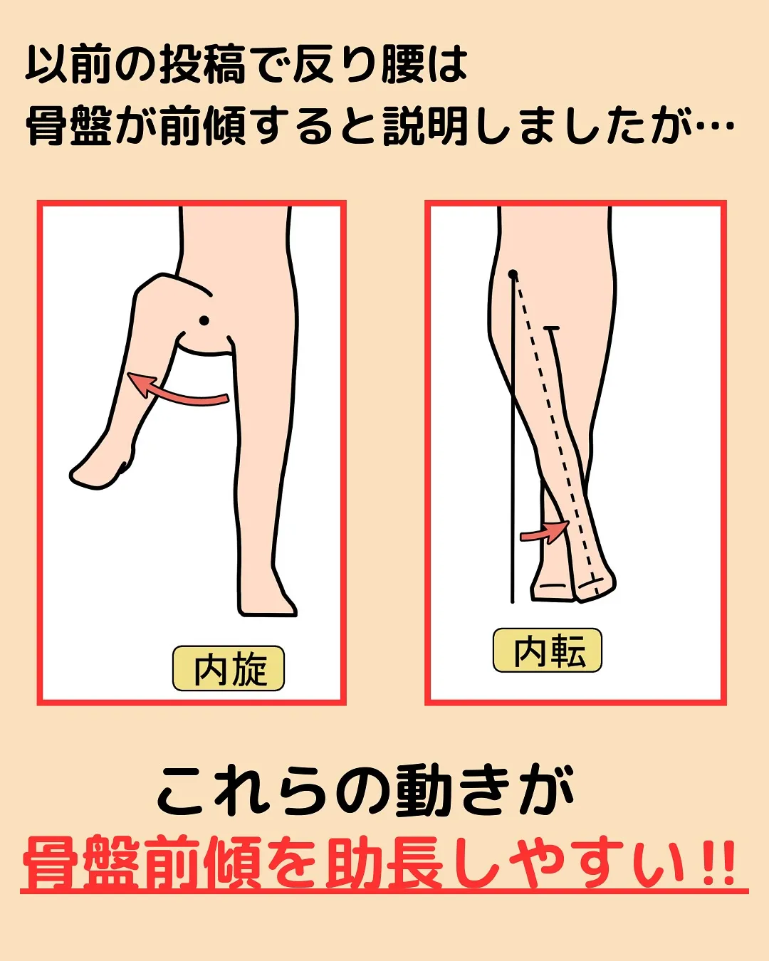 【姿勢改善‼️反り腰改善Part4✨】
