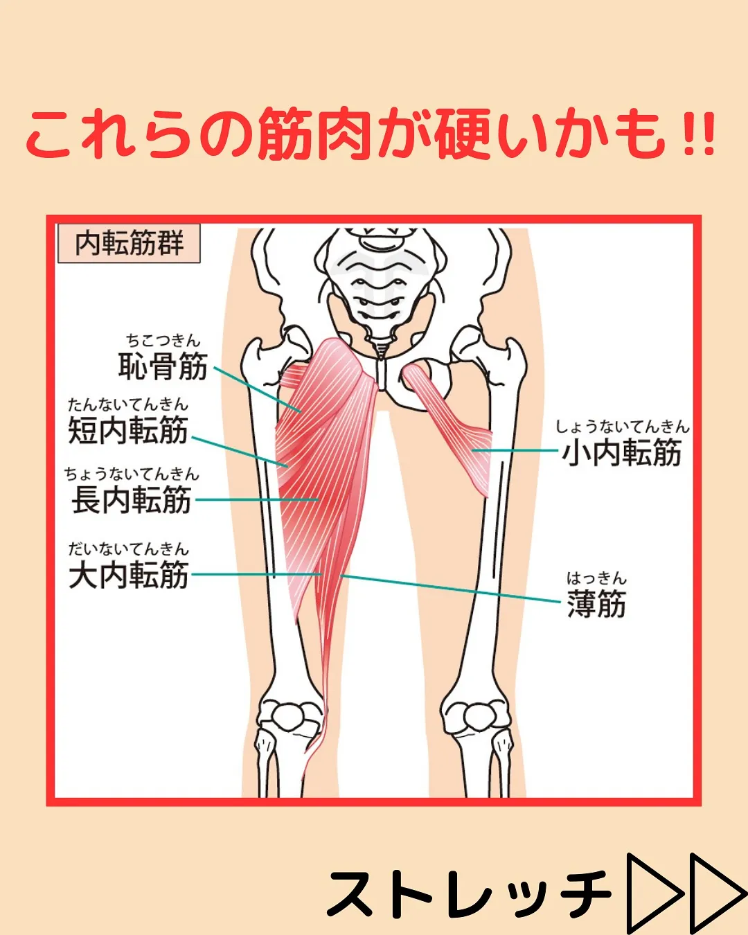 【姿勢改善‼️反り腰改善Part4✨】