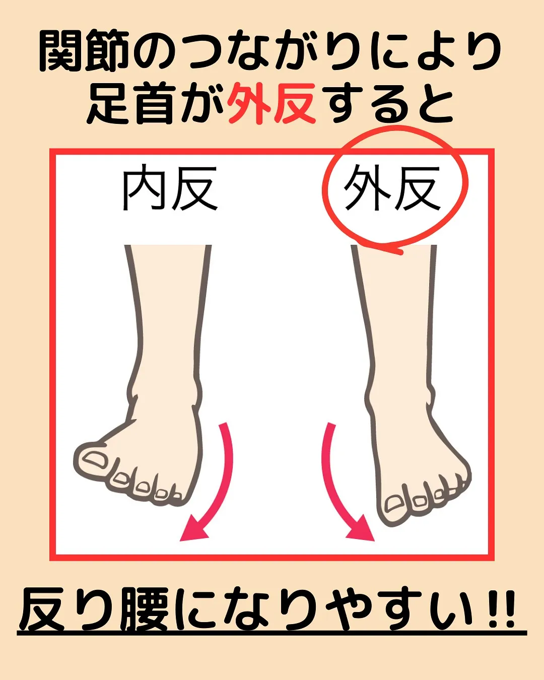 【姿勢改善‼️反り腰改善✨】