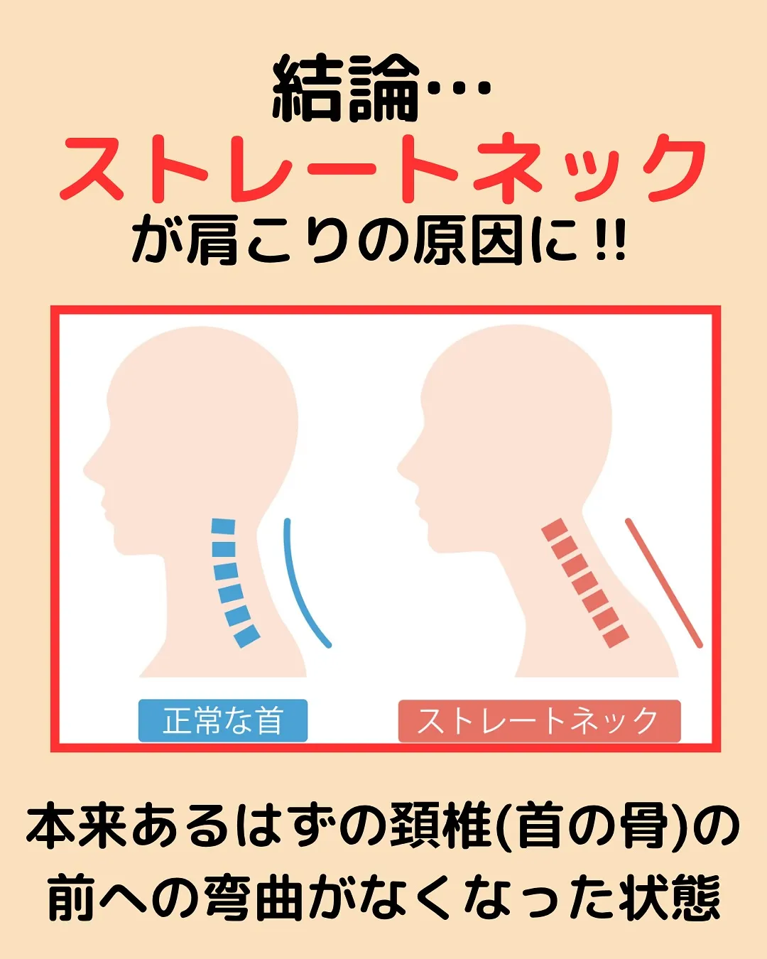 【肩こり改善Part3‼️肩こりを頭の位置から紐解く✨】