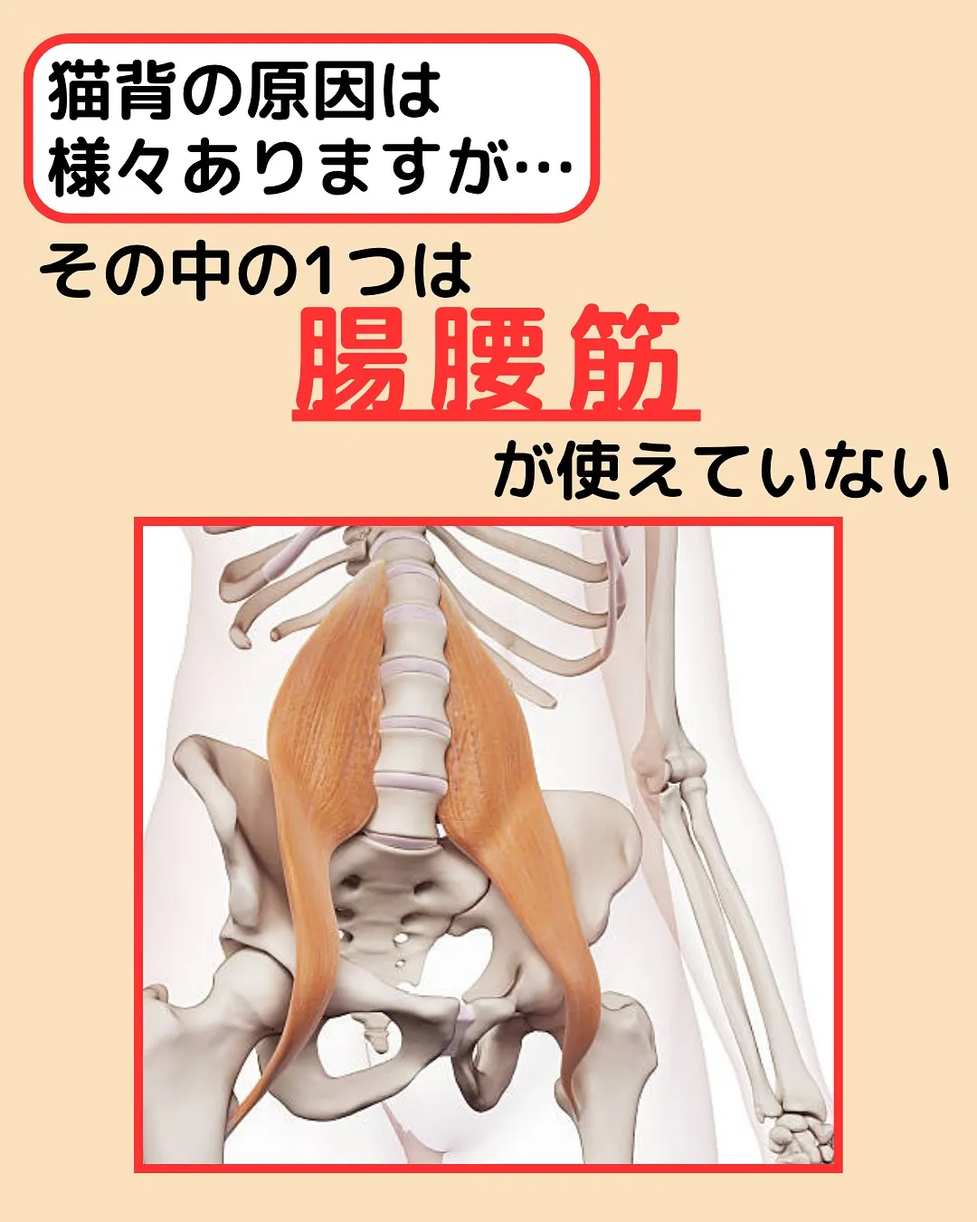 【猫背検査‼️やってみて✨】