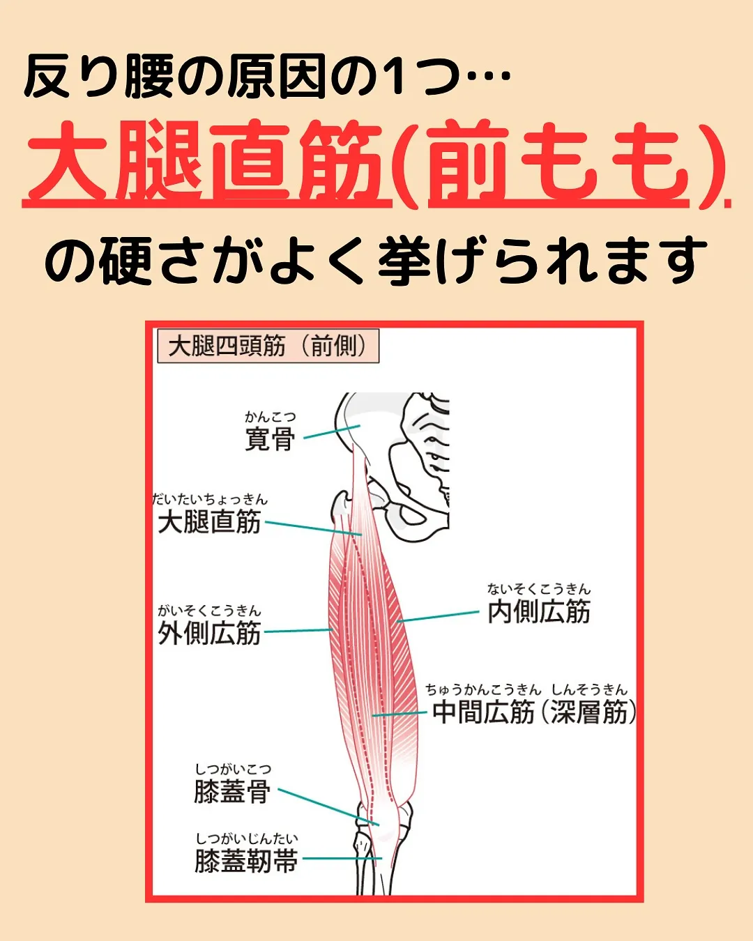 【反り腰検査‼️やってみて✨】