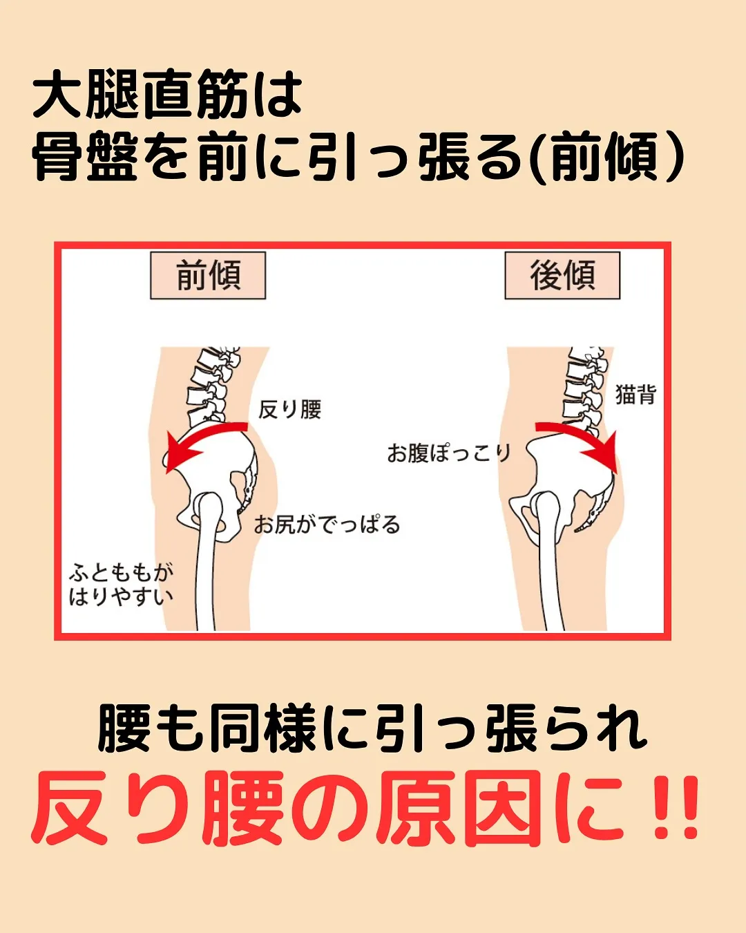 【反り腰検査‼️やってみて✨】